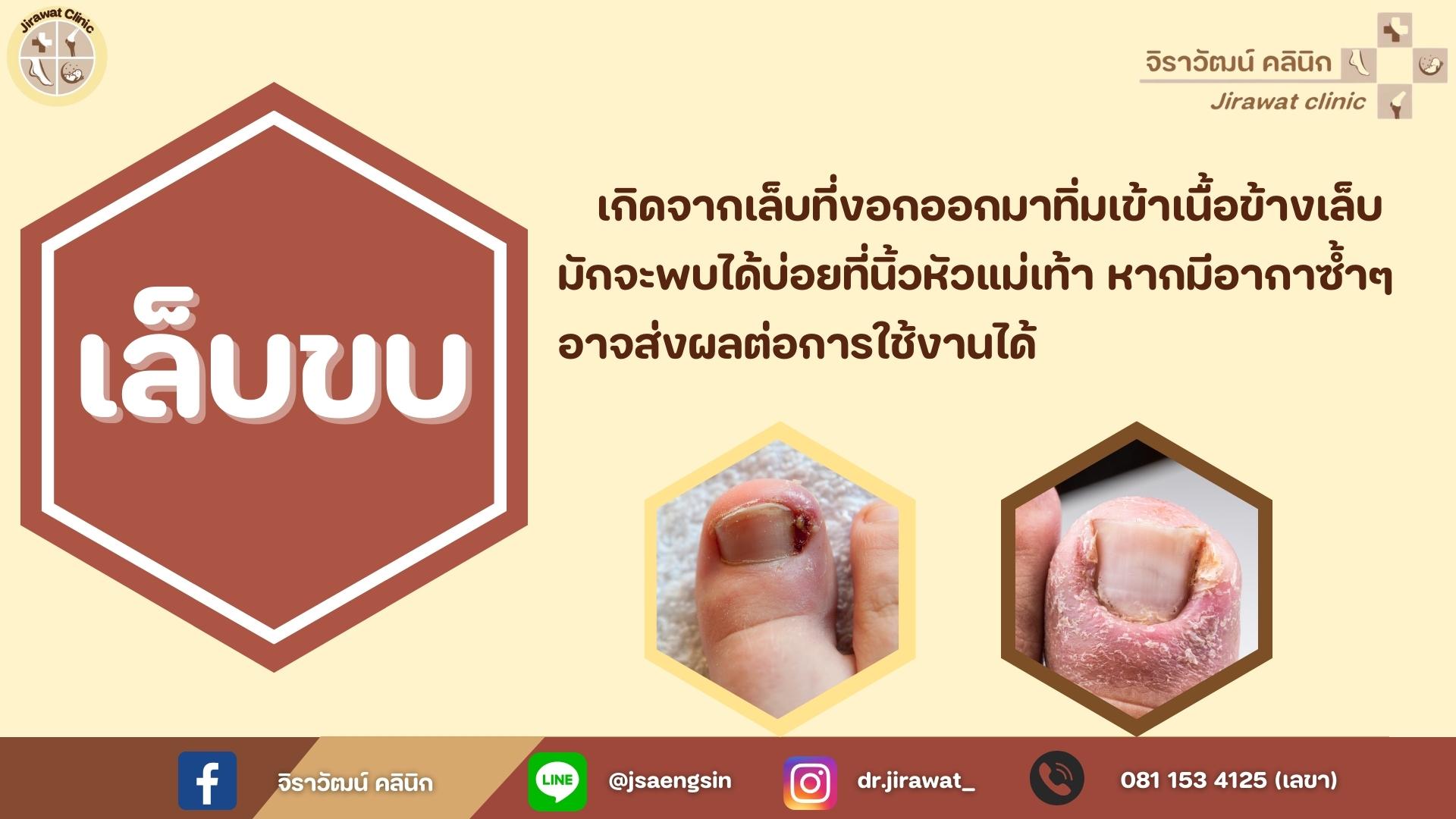 จิราวัฒน์ คลินิก - ภาพที่ 2